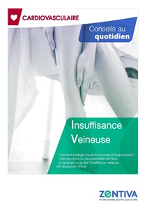 Commet soulager vos jambes lourdes et douloureuses : Insuffisance Veineuse